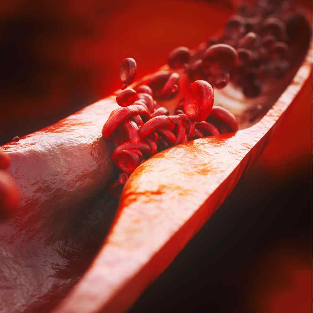 https://hydrationcorner.com/wp-content/uploads/2021/08/inner_image_04-3.jpg